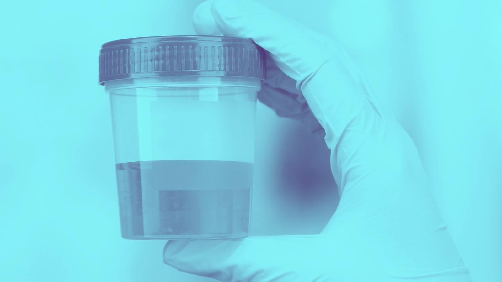 Infecciones Urinarias