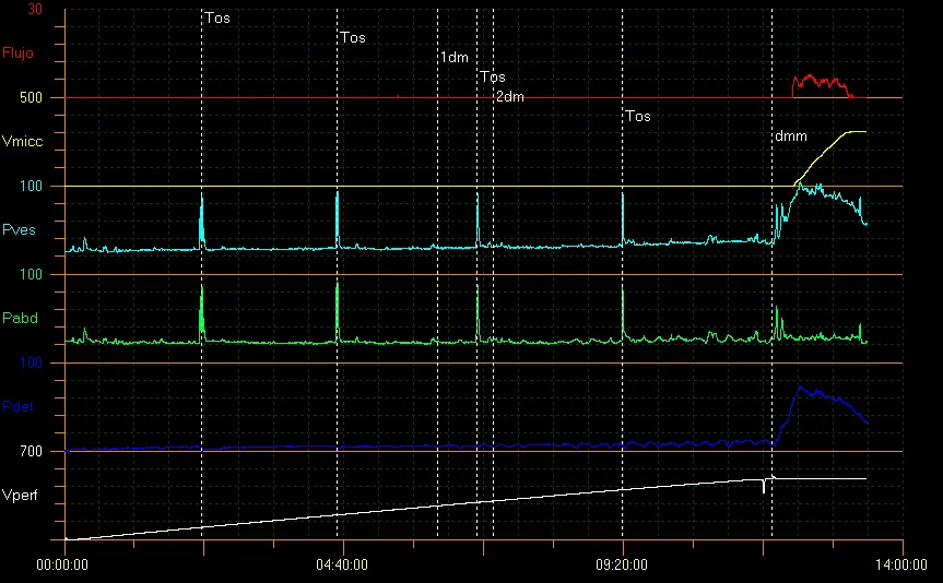 Examen de Urodinamia en Guayaquil Dr. Pablo García