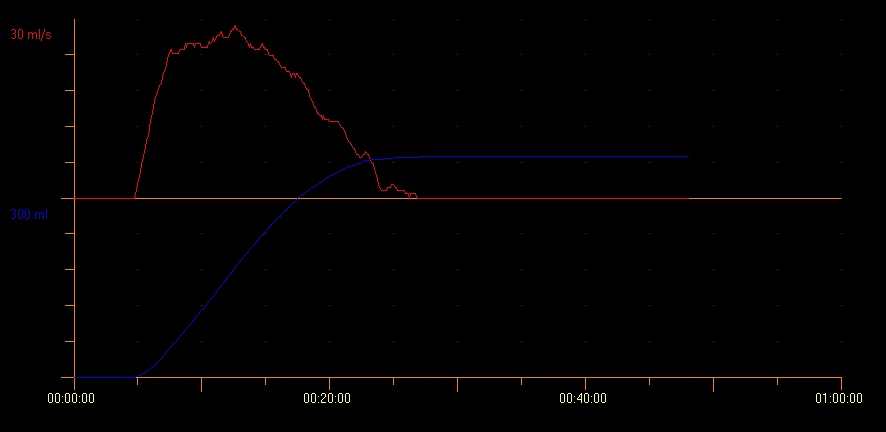 Examen de Uroflujometría Guayaquil